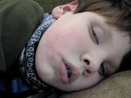 calvin's story: March 2013