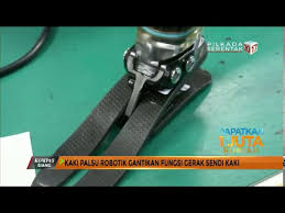 Kaki palsu, kota madiun, jawa timur. Kaki Palsu Robotik Gantikan Fungsi Gerak Sendi Kaki Youtube