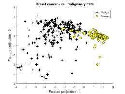They projected that the proportion of new breast cancer cases that occur among women age 50 to 69 will decrease from 55 percent in 2011 to 44 percent in 2030. Github Niravjain Breast Cancer Diagnosis Using Logistic Regression The Purpose Of This Project Is To Implement A Machine Learning Technique Called Logistic Regression To Identify Whether A Given Breast Tissue Sample Is Cancerous Or Not