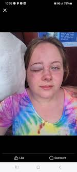 Boat tour accident in Zakynthos with Orestis Boat Tours