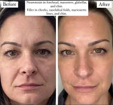 How is Abby Delray South? Are they a good Rehab facility for a 30 day stay?  Or other ideas would be helpful. Looking at Yamato Rehab in Boca .