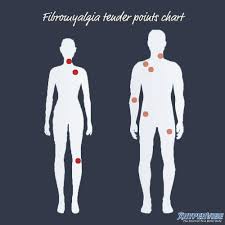 The size of the most tender point is. Trigger Points Vs Tender Points In Fibromyalgia Hypervibe Australia