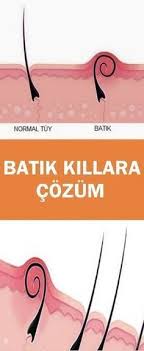 Batik Killara Cozum Cilt Tedavileri Dogal Cilt Bakimi Saglikli Cilt Bakimi