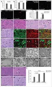Maybe you would like to learn more about one of these? Nes Wdr45 Fl Y Mice Show Axon Swelling A The Number Of Purkinje Download Scientific Diagram