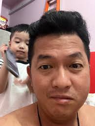 第二天了.还很肿