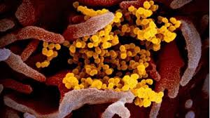HMPV वायरस का एक और केस मिला, अब पुडुचेरी में 5 साल की बच्ची संक्रमित -  Another case of HMPV virus found now Five year old girl infected in  Puducherry ntc - AajTak