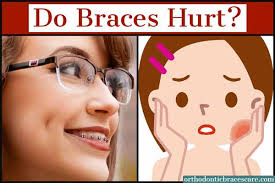 Trust alimed for your bracing needs, including unique & hard to find designs. How Much Do Braces Hurt On A Scale 1 10 Orthodontic Braces Care