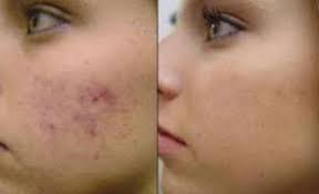 Medicina estetica dott.ssa Paola Corner