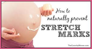 Diy body oils that have been made with pure essential oils then diluted with the appropriate carrier oil won't contain any hidden water, and has to be one of the best body treatments you can use. How To Naturally Prevent Stretch Marks