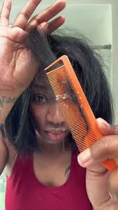 Flakes were flaking. So many. #sebboricdermatitis #sebborheicdermatitis  #dandruff #scalpcare #flareup #scratch #asmr #dryscalp #scratching