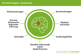 Die mehrzahl der betroffenen klagt über übelkeit, erbrechen und kopfschmerzen. Hirnblutungen Ursachen Symptome Diagnose Behandlung