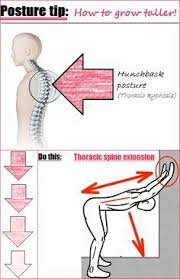 Having A Hunchback Posture Also Known As Having Excessive Thoracic Kyphosis Can Actually M Scoliosis Exercises Posture Exercises Posture Correction Exercises