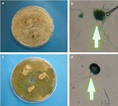 Its name is adapted from the latin name aspergillum, which means holy water sprinkler because it has a sprinkler like an appearance when. A Aspergillus Alliaceus Colonies Pale Buff To Ginger Brown With Download Scientific Diagram