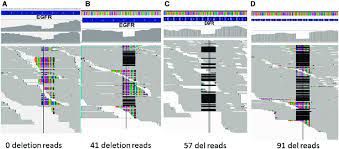 Rna Seq Alignment By Star And Gsnap For The Egfr 15 Base Deletion In Download Scientific Diagram