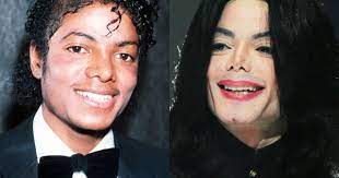 Unfortunately, accidents, age or genes can lead to a loss of full or partial vision, leaving us with a foggy or blurred vie. Celebrity Plastic Surgery Disasters Cbs News