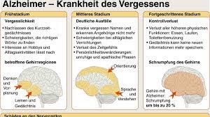 Als alzheimer wird eine erkrankung des gehirns bezeichnet, die sich durch eine abnahme der geistigen leistungsfähigkeit und persönlichkeitsstörungen äußert. Alzheimer Munchner Forscher Entdecken Alarmsignale Gesundheit