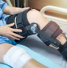 Acl reconstruction surgery involves replacing a torn anterior cruciate ligament with graft tissue from around the knee. Acl Reconstruction Surgery Acl Surgery Specialist In Singapore