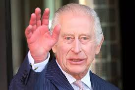 The cause of King Charles' 'sausage fingers' and what NHS and doctors say  about condition