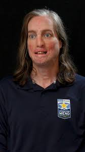 To help veterans like Sam Hargrove overcome their anger and survivors'  guilt, UCLA Operation Mend partners with Wounded Warrior Project to deliver  life-changing treatment through Warrior Care Network. When Sam knew she