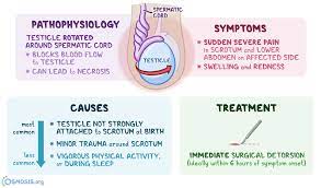 Testicular pain is pain or discomfort that is felt in one or both testicles. Testicular Torsion What Is It Causes Pain Appearance Treatment And More Osmosis