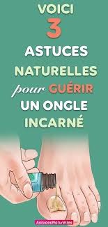 Vous pouvez voir ce site qui sera certainement bénéfique pour vous. Pin On Remedes Naturels