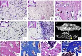 Download slideshare pdfs for free. Radiographic And Histologic Evaluation Of Experimentally Induced Severe Intrusive Luxation Of Immature Teeth In Rats Journal Of Endodontics