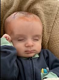 Fundraiser for Cassandra Jacobson by liz allison : Help Loyal Overcome  Medical Challenges