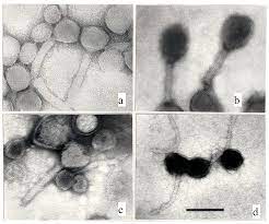 The lambda genome is 48.5 kb (compared to that of t4 which is 172 kb). Microorganisms Free Full Text Sad State Of Phage Electron Microscopy Please Shoot The Messenger Html