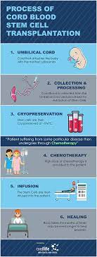 Cord blood has established uses in transplant medicine; Process Of Cord Blood Stem Cell Transplantation Infographics