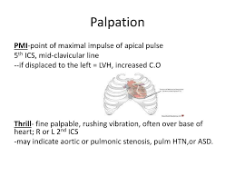 Image result for Point of Maximum Impulse