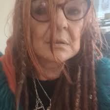 Is itching a symptom of fibromyalgia?