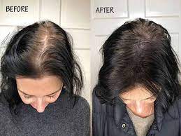 While onion juice may seem like an odd treatment for thinning hair, there are a number that is one more reason that onion juice is an effective treatment for hair loss. People Are Trying Onion Juice For Hair Growth Why Don T You