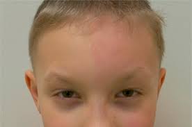 Image result for Harlequin Color Change