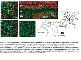 Image result for Eye Rest Green 1972 Hussmann