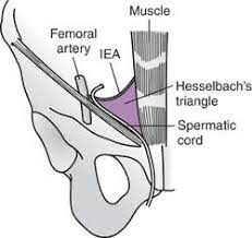 Medical definition of triangle of hesselbach: Hesselbach Triangle Definition Of Hesselbach Triangle By Medical Dictionary