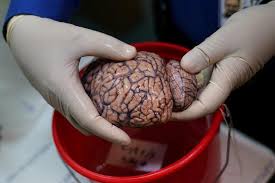 Перевод слова brain, американское и британское произношение, транскрипция, словосочетания, однокоренные слова, примеры использования. Brains In The Bronx Reuters Com