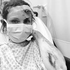 Submitted 4 months ago by tuarusukdefiant. Sophie Ellis Bextor Posts Hospital Image Of Gory Cycling Crash People Com