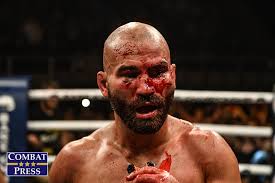 Bare knuckle boxing might be safer version of boxing for trauma and concussions. Bare Knuckle Fighting Championship 6 Malignaggi Vs Lobov Live Stream And Results
