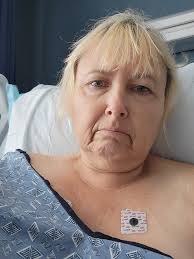 Total knee replacement recovery experience