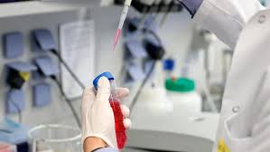 El producto de moderna está en un término medio. La Vacuna De Moderna O La De Oxford Asi Esta La Carrera Por Conseguir Una Formula Contra El Coronavirus