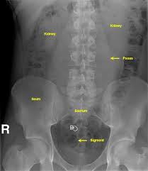 Untitled Document Radiology Imaging Radiology Humor Medical Knowledge