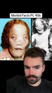 Exploring Morbid Facts: The Dark Side of History