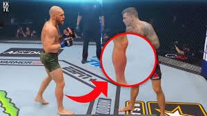 The fight is off btw by the way. The Damage Done To Conor Mcgregor At Ufc 257 His Leg Was A Balloon