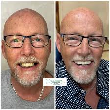 Hi Dent Dr. Ashraf Kamel (@hi.dent.egy) • Instagram photos and videos