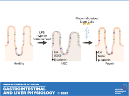 Little nevaeh brown is a miracle in the making special to the gazette. Human Placental Derived Stem Cell Therapy Ameliorates Experimental Necrotizing Enterocolitis American Journal Of Physiology Gastrointestinal And Liver Physiology