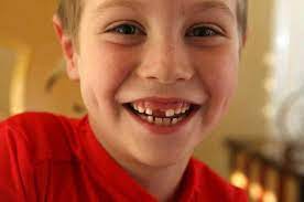 Am vrut să verific temeiul acestei credinţe (ce aşadar, pierderea dinţilor în vis nu este în mod sistematic o premoniţie a morţii. De Ce Visez SÄƒ Trag Un Dinte TrageÈ›i Un Dinte Intr Un Vis