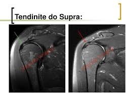 PPT - OMBRO PowerPoint Presentation, free download - ID:936239