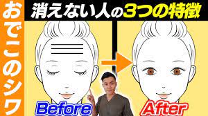 ボード アンチエイジング のピン