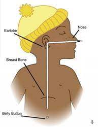 Check spelling or type a new query. Nasogastric Tube Feeding Using A Feeding Pump