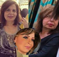حسن يوسف وزوجته شمس البارودي. Ù„Ù† ØªØµØ¯Ù‚ÙˆØ§ ÙƒÙŠÙ Ø£ØµØ¨Ø­ Ø´ÙƒÙ„ Ù…Ù†Ù‰ Ø¹Ø¨Ø¯ Ø§Ù„Ù…Ø¬ÙŠØ¯ Ù…Ø¬Ù„Ø© Ù‡ÙŠ